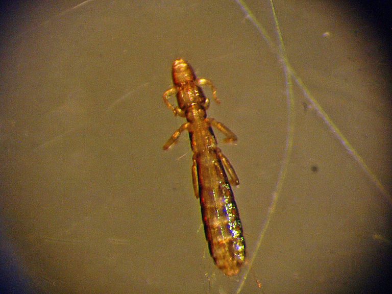 Detalle microscópico de un piojo de pájaro